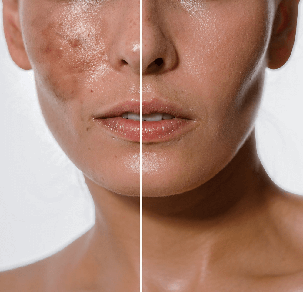 Jabón Exfoliante Luz de Oro 2x1 - Aclara manchas y renueva tu piel